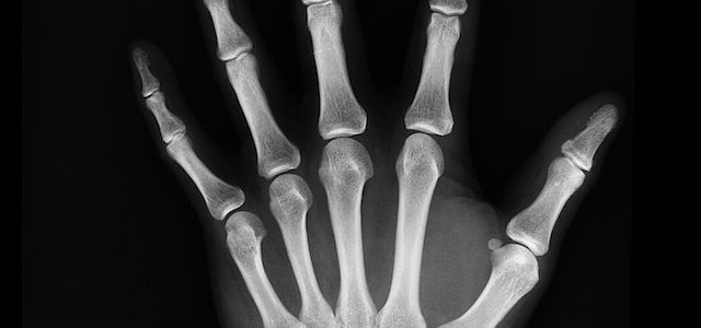 X-Ray Near Me Urgent Care in Arlington