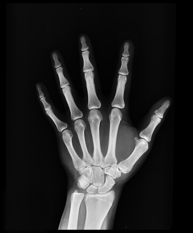 X-Ray Near Me Urgent Care in Arlington
