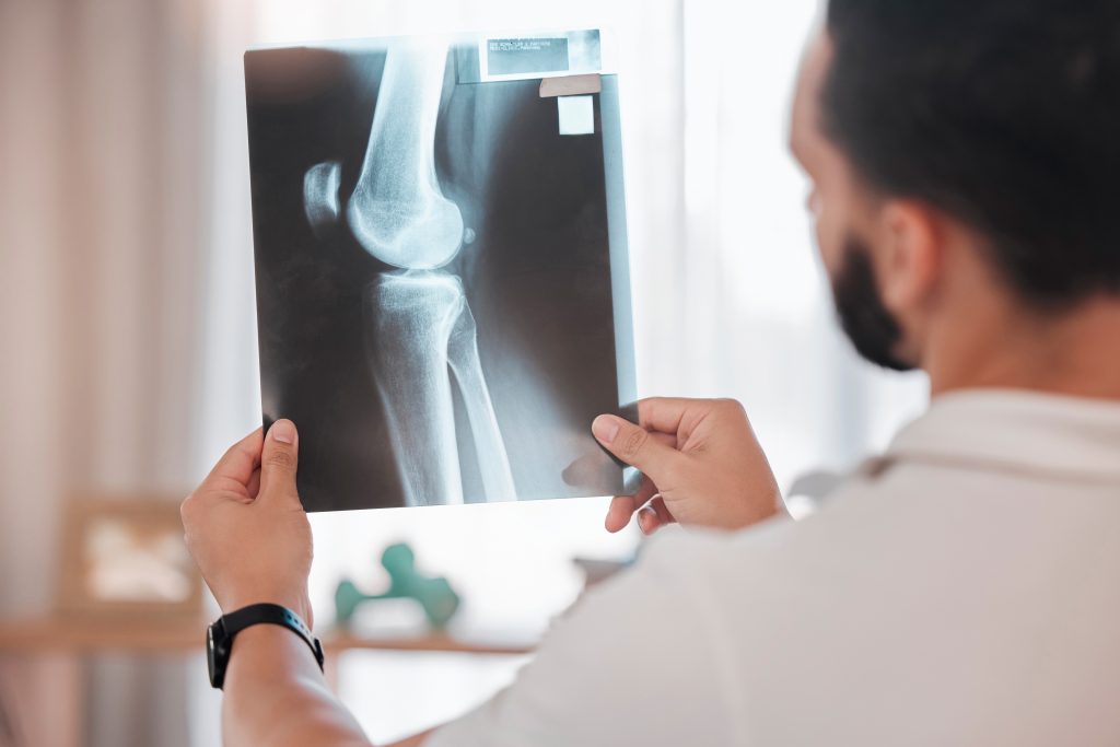 Health X Ray And Physiotherapy Man Physiotherapi 2022 12 29 04 26 46 Utc