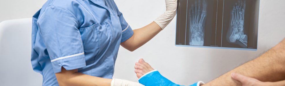 Broken bone orthopedic urgent care