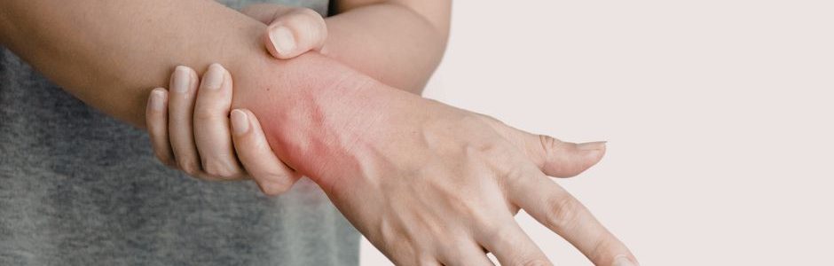 OrthoOIC - Common Winter Wrist Injuries in Northern Virginia